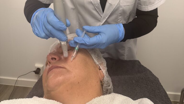 Opleiding Microneedling
